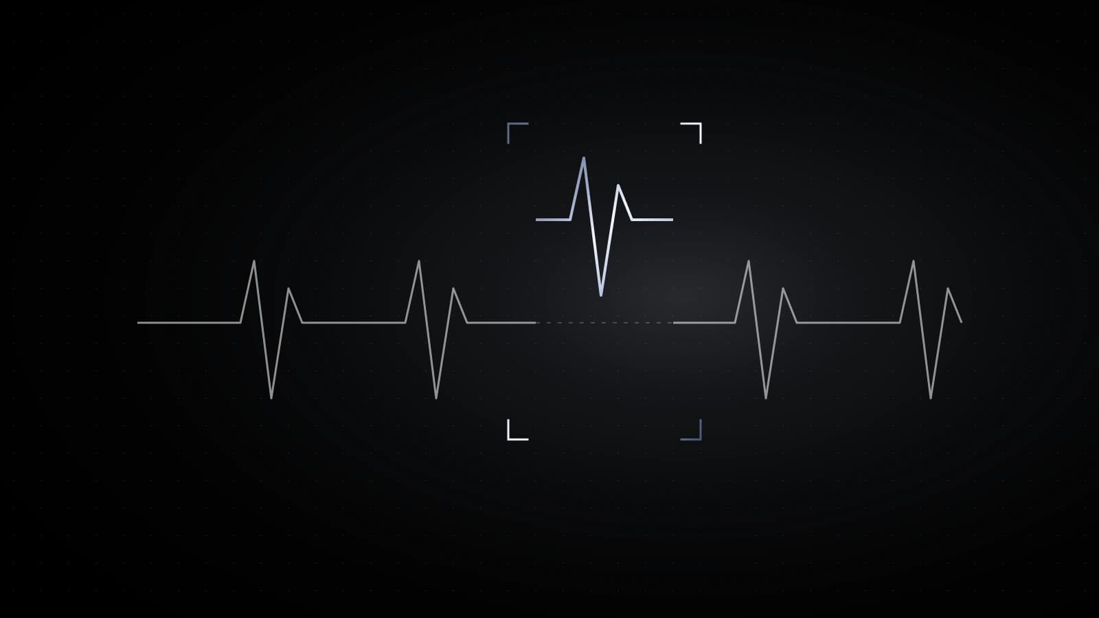 A thin heartbeat line drawn in white across black, one segment lifted out in steel and drifting upward.